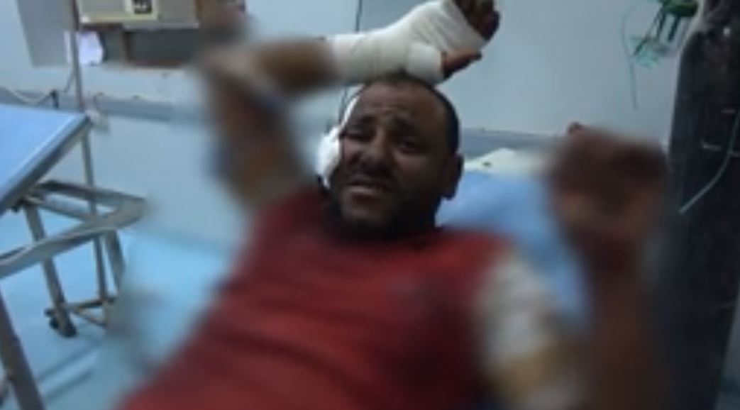 مقتل مواطن واصابة شقيقه إثر قصف شنته جماعة الحوثي على الاحياء السكنية في مدينة حيس