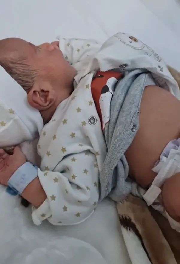 حالة تحدث لاول مره في اليمن .  مولود يحمل شقيقه داخل بطنه !