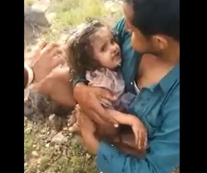 إنقاذ طفلة يمنية بعد تكميم فمها ووضعها من قبل زوجة ابيها في حفرة (فيديو)
