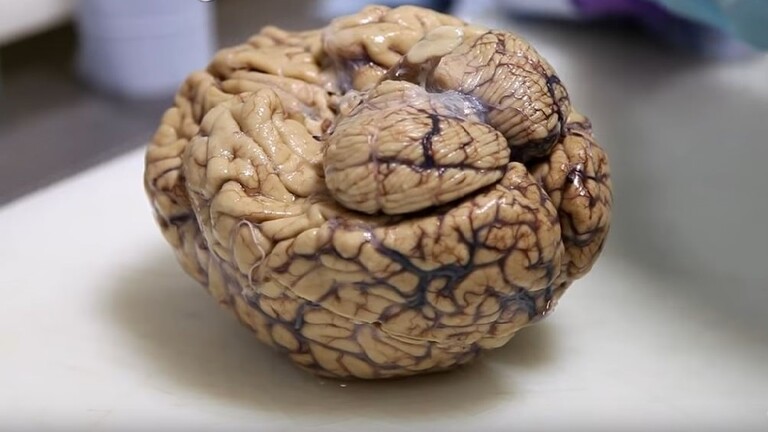 اكتشاف دماغ غامض في جمجمة مقتول عمره اكثر من 2600 سنة