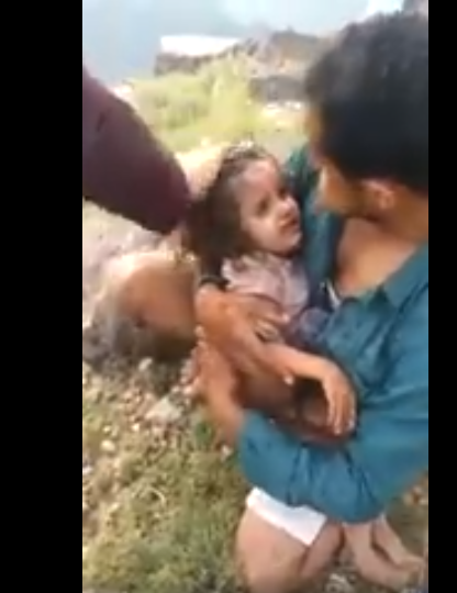 اشبه بالمعجزة .. طفلة يمنية على قيد الحياة بعد ثلاث أيام من قيام زوجة ابيها بوضعها داخل قبر 