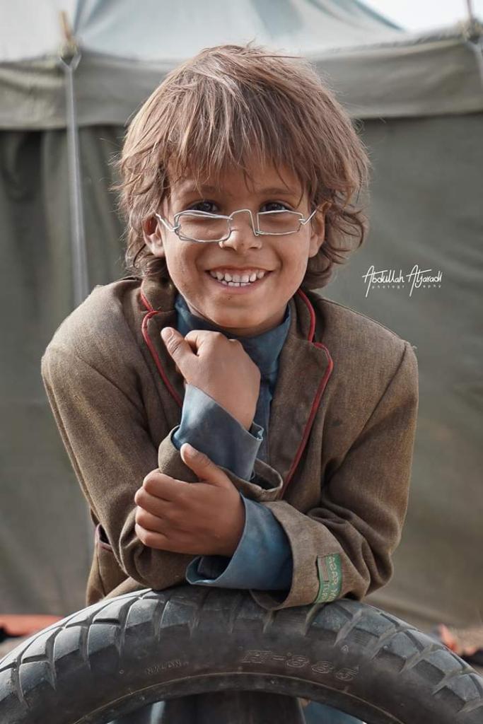 شاهد كم بلغ ثمن النظارة التي ابتكرها طفل يمني نازح من اسياخ تعليق الملابس !! 